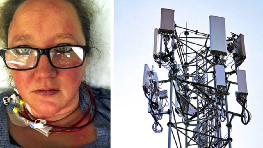 5G Caused Woman To Have 51 Strokes - Truth In News