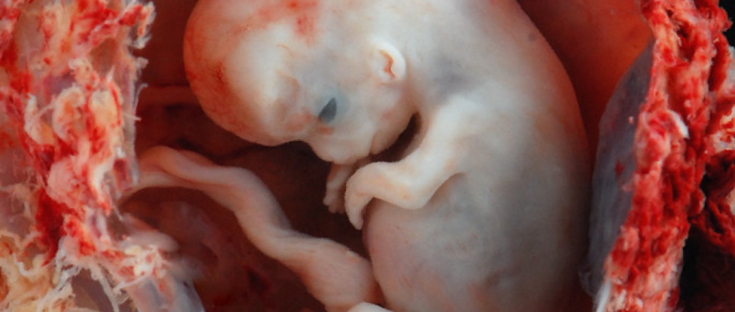 Unregulated IVF Destroys More Babies Annually Than Abortion Industry