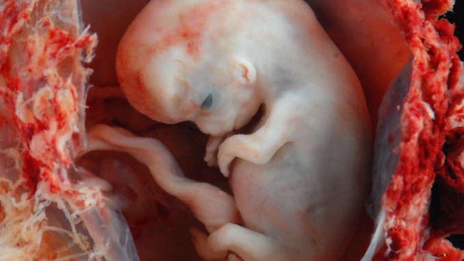 Unregulated IVF Destroys More Babies Annually Than Abortion Industry