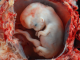 Unregulated IVF Destroys More Babies Annually Than Abortion Industry