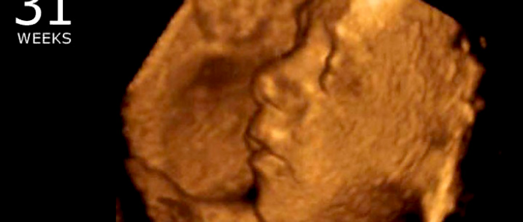 States With Unlimited Abortions Kill So Many Babies They’re Below Replacement Rate