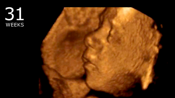 States With Unlimited Abortions Kill So Many Babies They’re Below Replacement Rate