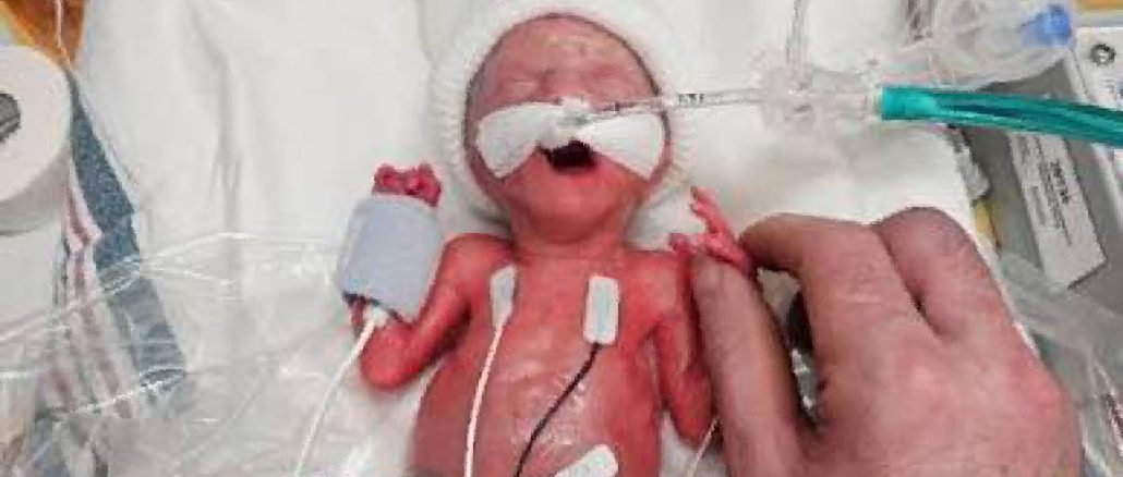 Here’s What a 24-Week Baby Looks Like, Massachusetts Just Legalized Killing Them Before Birth