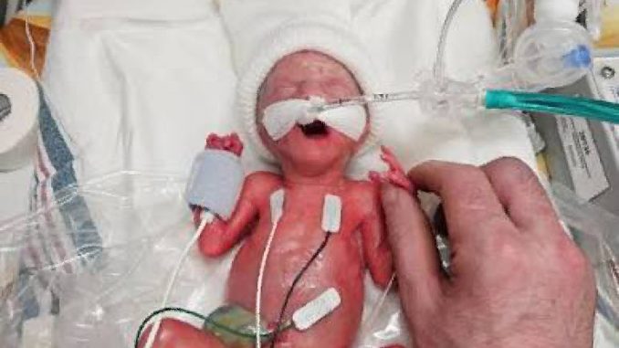 Here’s What a 24-Week Baby Looks Like, Massachusetts Just Legalized Killing Them Before Birth